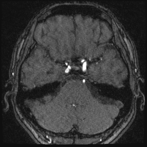 Click on the Serie image to view the images of VILLANUEVA, WILLIAM A.